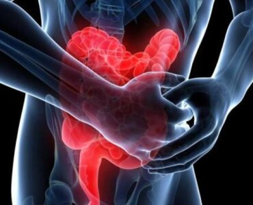 Why Regular Follow-Up Is Important for IBD Patients The Key to Long-Term Health Why Regular Follow-Up Is Important for IBD Patients The Key to Long-Term Health