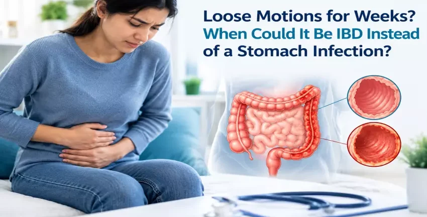 Loose Motions for Weeks